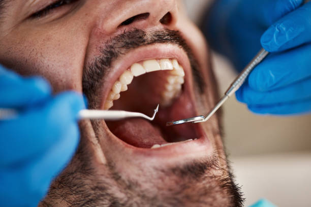 Best Same-Day Emergency Dentist in Mount Carmel, PA